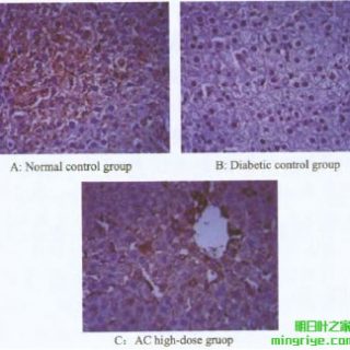 图2 肝细胞 Ins R 蛋白的表达水平