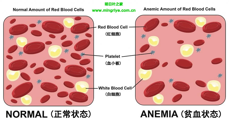 贫血红细胞与正常红细胞数量对比