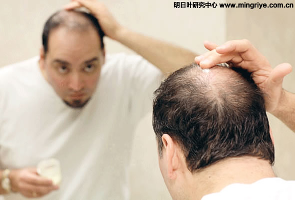 头发问题 hair-problems